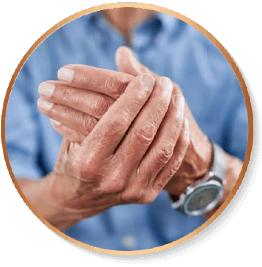 Artrite, Artrose e Reumatismo